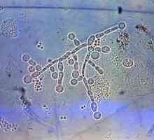 Gljivice slične kvasca roda Candida