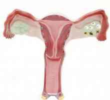 Dvostruka ovulacija: uzroci i simptomi