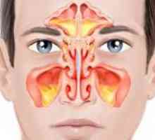 Bilateralni sinusitis: simptomi i liječenje