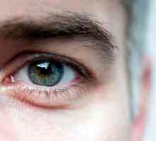Eyeball - što je to? Skleroza leće oka: uzroci, simptomi i liječenje