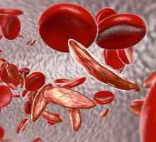 Frakcije krvnih proteina elektroforezom