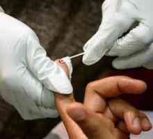 Gdje i kako uzimati anonimno HIV testove