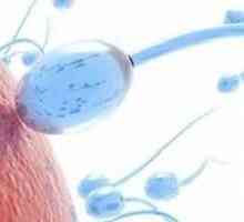 Gdje uzeti spermogram? Rezultati, interpretacija analize