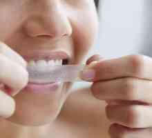 Gel za izbjeljivanje zubi - jednostavan, koristan i učinkovit!
