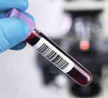 Hematološka analiza krvi