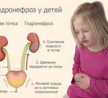 Hidronefroza u djece: stupanj, simptomi, liječenje, operacija