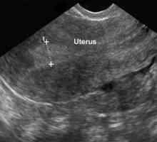 Ginekološki ultrazvuk: na koji dan ciklusa, gdje treba raditi, dekodiranje