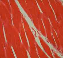 Mirno mišićno tkivo: značajke strukture. Svojstva glatkog mišićnog tkiva
