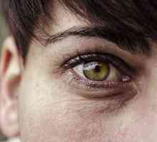 Kapi za oči "Oftan Dexamethasone": upute za uporabu, recenzije