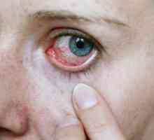 Crvi u oku: uzroci i dijagnostika