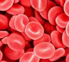 Krvava krv: što učiniti i što se bojati?