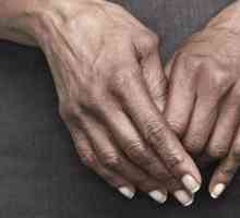 Klamidijski artritis: simptomi, uzroci, vrste i liječenje