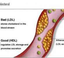 Kolesterol: norma u žena nakon 50 godina (tablica)