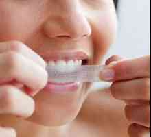Dobra sredstva za izbjeljivanje zubi. Učinkoviti lijekovi i metode izbjeljivanja zubi