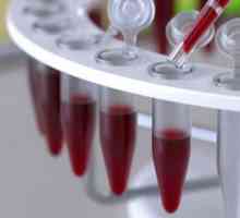 Imunoenzimska analiza krvi: tumačenje rezultata