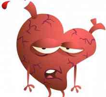 Ishemijska srčana bolest. Što je to i koje su njegove manifestacije?