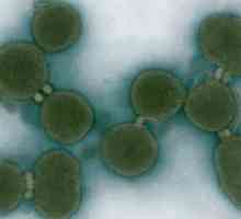 Umjetna bakterija `Cynthia` (fotografija)