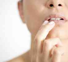 Bolovi u ustima: liječenje kod kuće