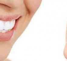 Elainers: recenzije o kappa za poravnavanje zuba