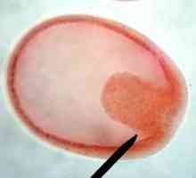 Эмбриология - это... История эмбриологии