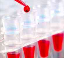 Kako se pripremiti za isporuku biokemijskog testa krvi? Kako je priprema za isporuku krvi za…