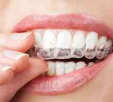 Kako i kako bijeliti zube kod kuće? sredstva