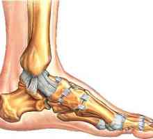 Kako liječiti stezanje ligamenta na nozi. Sprječavanje istezanja: liječenje i daljnji oporavak