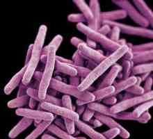 Kako je dijagnosticirana tuberkuloza u početnoj fazi?