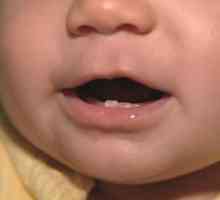 Kako razlikovati dječji zub od korijena djeteta?