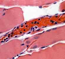 Kako smanjiti leukocite u krvi? Uzroci povišenih bijelih krvnih stanica. Liječnički savjet kako…