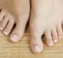 Kako ispravno smanjiti nokte na nogama: značajke i preporuke