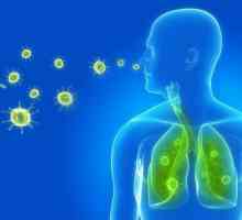 Kako se manifestira upala pluća? Simptomi, uzroci
