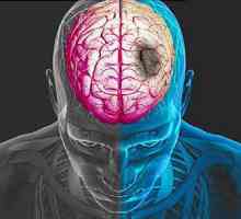 Kako prepoznati moždani udar pravodobno?