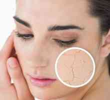 Kako ukloniti skaliranje na licu? Savjeti za njegu kože