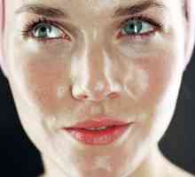 Kako smanjiti sadržaj masnoće kože lica kod kuće: učinkoviti načini, recepcije i recenzije