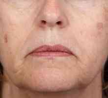 Kako ukloniti pigmentne mrlje na licu: savjeti i trikovi