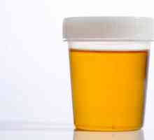 Koje boje treba urin imati u zdravih osoba?