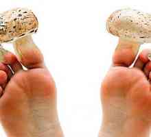 Koji liječnik tretira noktiju gljiva na svojim nogama - mikolog ili dermatolog?