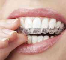 Kapy za izbjeljivanje zubi kod kuće: recenzije
