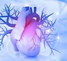 Kardiogeni šok: uzroci, dijagnoza, simptomi, hitna briga