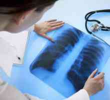 Kašalj s tuberkulozom: značajke i simptomi