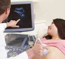 Kada napraviti treći ultrazvuk u trudnoći? U koje je vrijeme planirano 3 ultrazvuka u trudnoći?