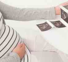 Kada počinje povraćati tijekom trudnoće: vrijeme, norma i karakteristike