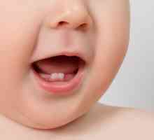 Kada se zubi počinju rezati djecom: dob, simptomi, fotografija