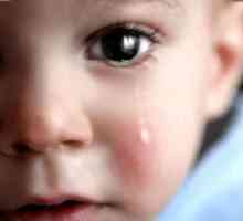 Kada ima suza u novorođenčadi? Norme i odstupanja