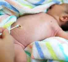 Kada pupak liječi novorođenče, značajke liječenja i preporuke