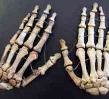Kosti ruku: imena i funkcije. Što učiniti ako su kosti ruke bol
