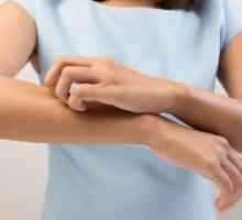 Crvene mrlje na dlanovima i nogama: uzroci, simptomi i značajke liječenja