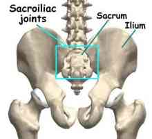 Sacroiliac joint: liječenje i prevencija bolesti
