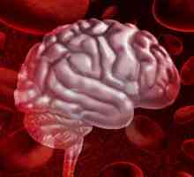 Hemorrhaga u mozgu: simptomi, liječenje, posljedice, prognozu